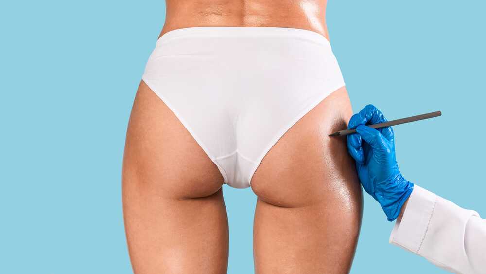 Cosmetic Injections for Butt Lift