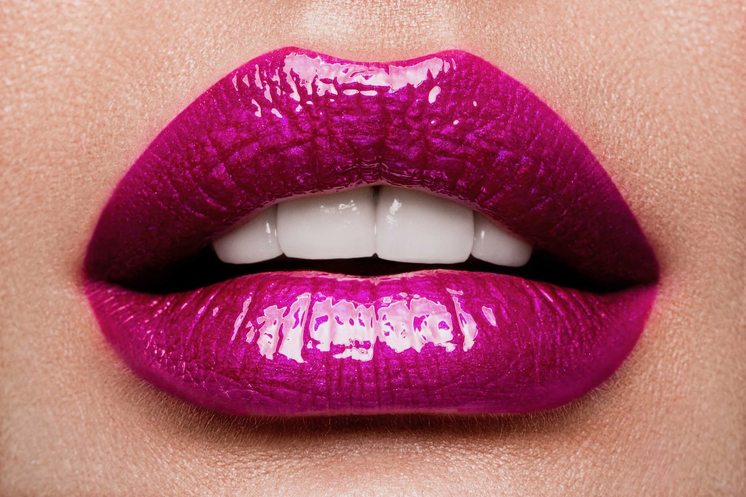 Which Lip Filler Lasts the Longest?