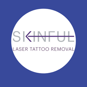 Skinful Tattoo Removal in Killeen, TX